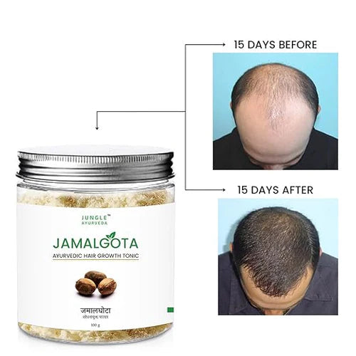 Jamalgota™ - Ayurvedic Hair Growth Powder 🌱✨ (Buy 1 Get 1 Free🔥) (200GM🔥)