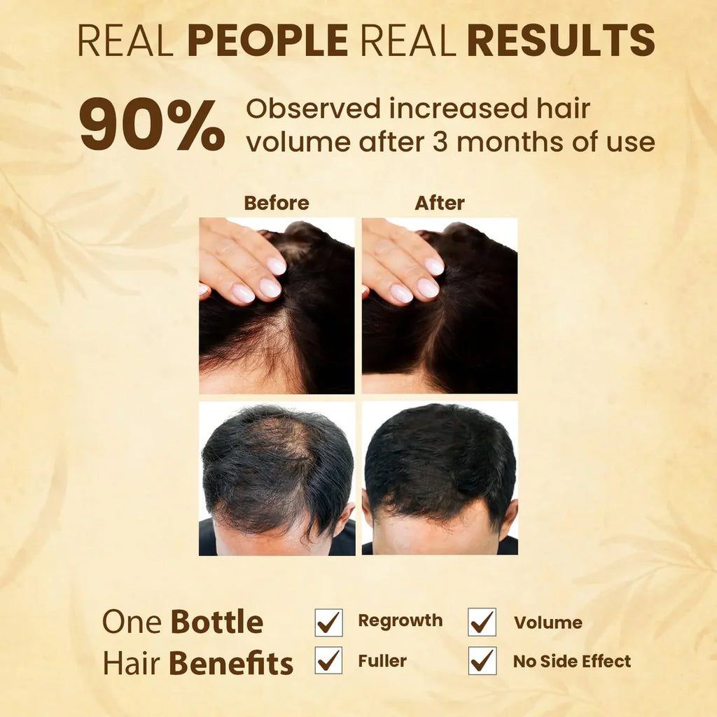 Jamalgota™ - Ayurvedic Hair Growth Powder 🌱✨ (Buy 1 Get 1 Free🔥) (200GM🔥)